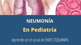 Neumonía en Pediatría [upl. by Areic]