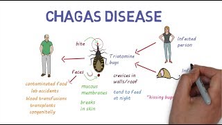 Chagas Disease  An overview [upl. by Althea]