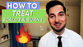 Burns  How To Treat Burns  How To Treat A Burn [upl. by Kus]