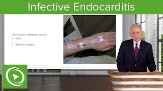 Infective Endocarditis IE Definition amp Epidemiology– Infectious Diseases  Lecturio [upl. by Edijabab]