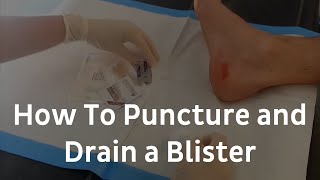 How To Puncture And Drain A Blister  Blister Treatment [upl. by Kelci]