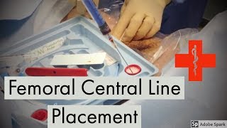 Femoral Central Line Placement [upl. by Lammaj]