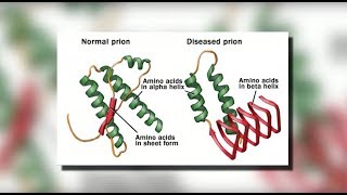 What is decompression sickness [upl. by Ryter740]