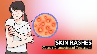 Skin Rash Causes Signs and Symptoms Diagnosis and Treatment [upl. by Dyer]