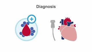 Endocarditis 101 Diagnosis and Treatment [upl. by Ihsoyim]